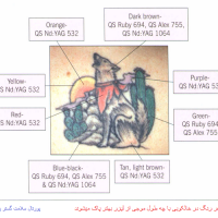 هر رنگ در خالکوبی با چه طول موجی از لیزر بهتر پاک میشوند