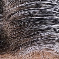 دلایل سفید شدن مو چیست؟