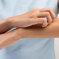 کهیر چیست؟