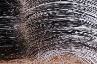 دلایل سفید شدن مو چیست؟