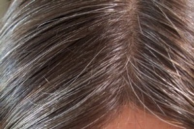 آیا میتوان از سفید شدن موی سر جلوگیری کرد؟