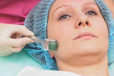  تکنولوژی میکرونیدلینگ (microneedling)