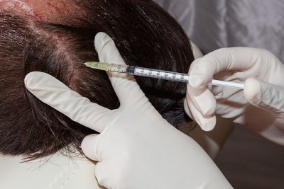PRP در درمان ریزش مو، بهتر است به تنهایی استفاده شود یا همراه با سایر داروهای تقویت کننده مو؟