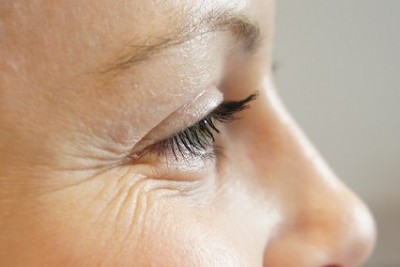 را ه های درمان چروک دور چشم و لک های قهوه ای که در صورت ظاهر شده اند؟