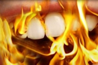 سندرم دهان سوزان (Burning mouth syndrome)