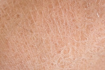 آیا برای رفع خشکی پوست استفاده از مرطوب کننده مناسب می باشد؟