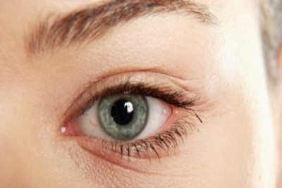 درمان چروک دور چشم چیست؟