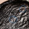 علت خارش و ریزش شدید موهای سر من چیست؟