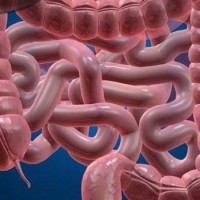 بیماری های التهابی روده و ریسک بالاتر برای بیماری های التهابی پوست