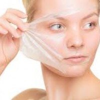 آشنایی با لایه برداری شیمیایی (peeling)