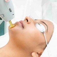 بهترین دستگاه های لیزر موی زائد با توجه به رنگ پوست افراد چیست؟