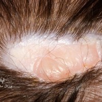 عکس آپلازی کوتیس مادرزادی