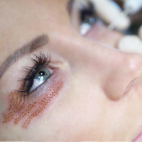 جوانسازی با تکنولوژی جدید 