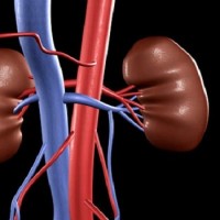 رتبه اول ایران در زمینه پیوند کلیه و اورولوژی در خاورمیانه 