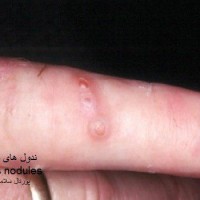 عکس ندول های شیردوشان