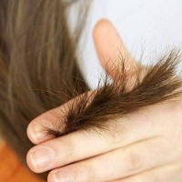 علل ایجاد موخوره (Trichoptilosis) و درمان آن