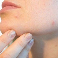 عوارض پوستی مواد آرایشی