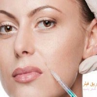 فیلر و کاربردهای آن در زیبایی 