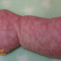 عکس کوتیس مارموراتا