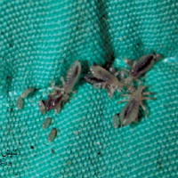 عکس شپش بدن