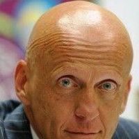 ریزش موی سکه ای یا ناحیه ای (Alopecia Areata)