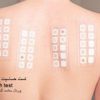 تست حساسيت پوستی 