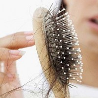 دلیل ریزش موهای من چیست؟