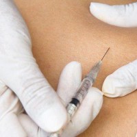 تفاوت مزوتراپی و بوتاکس در چیست؟