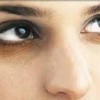 راهکارهای کاهش سیاهی دور چشم 