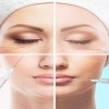 ژل تزریقی خوب باید چه مشخصاتی داشته باشد؟ 